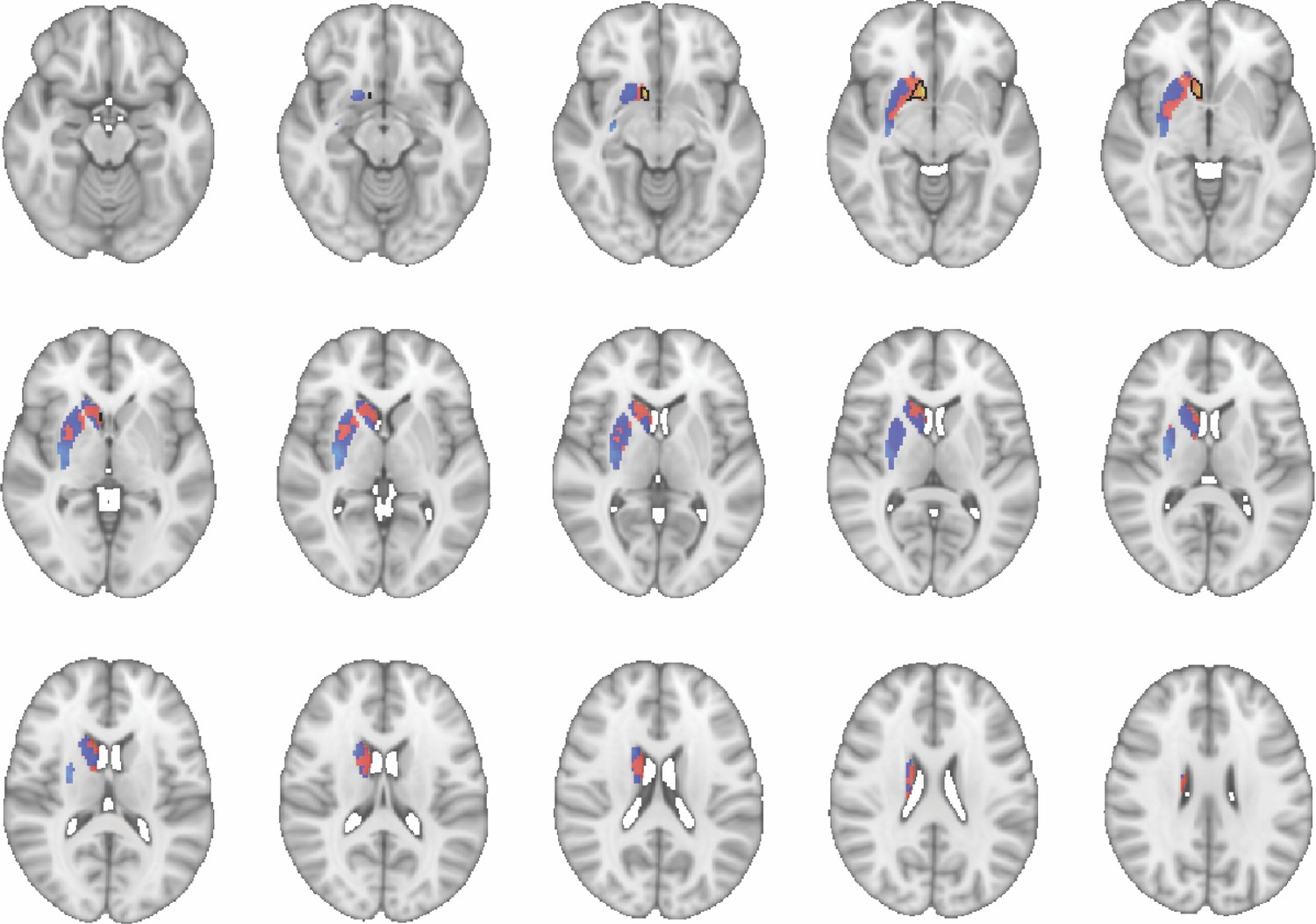 Figures and data in Primate homologs of mouse cortico-striatal circuits ...