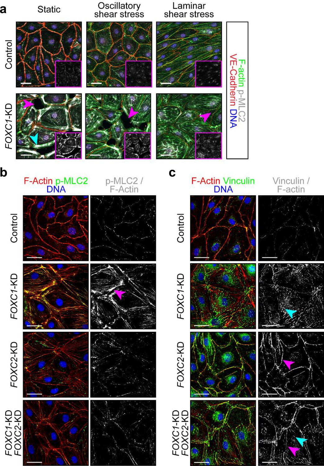 Shear stimulation of FOXC1 and FOXC2 differentially regulates ...