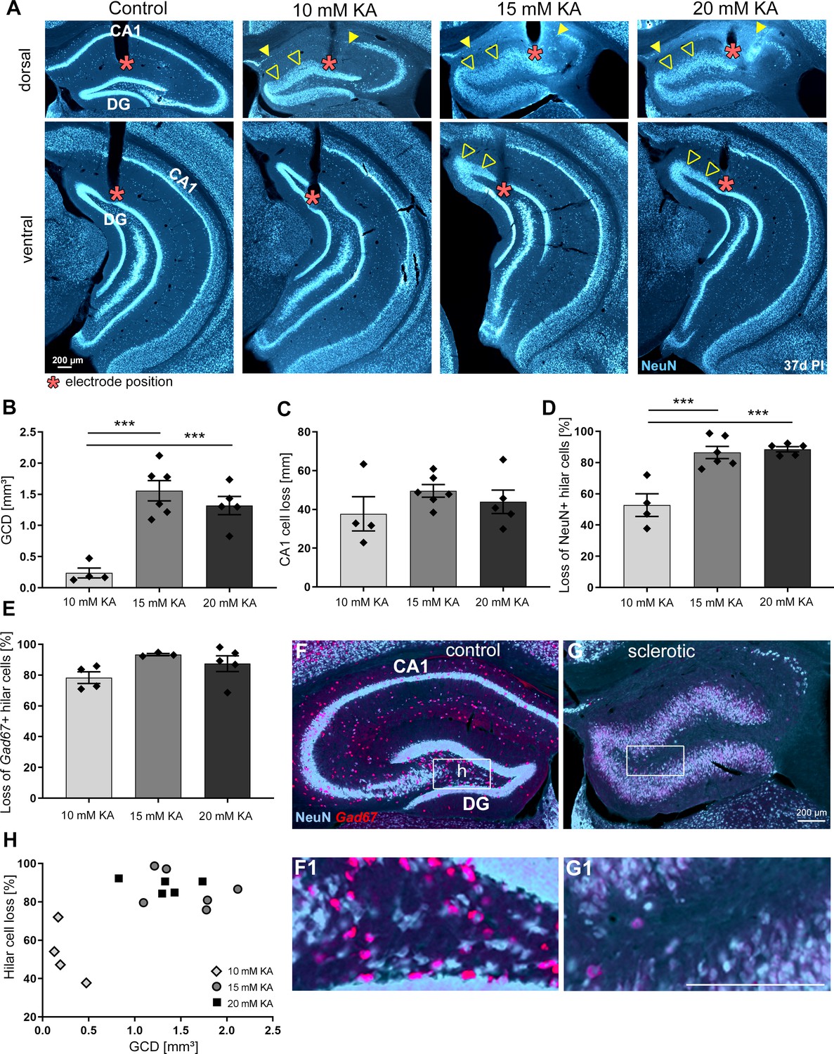 Hippocampal Low Frequency Stimulation Prevents Seizure Generation In A