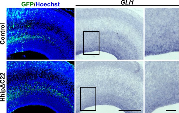 Figures and data in A discrete subtype of neural progenitor crucial for ...