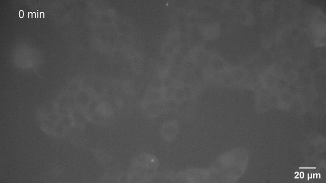Limited dishevelled/Axin oligomerization determines Limited dishevelled/Axin oligomerization determines