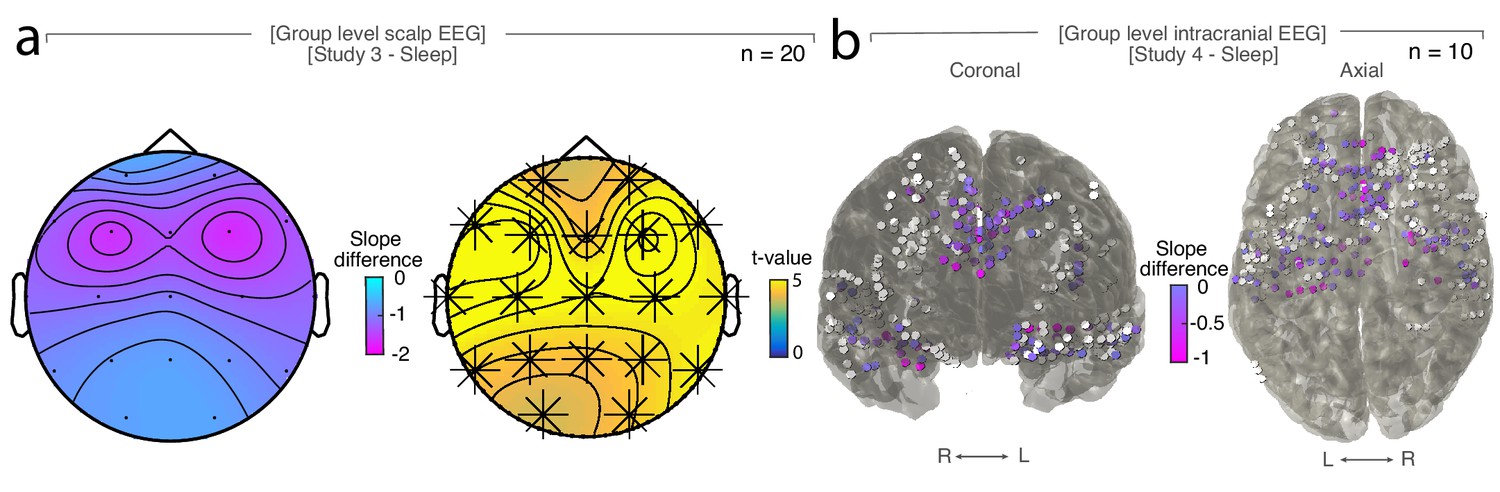 intracranial eeg and human brain mapping
