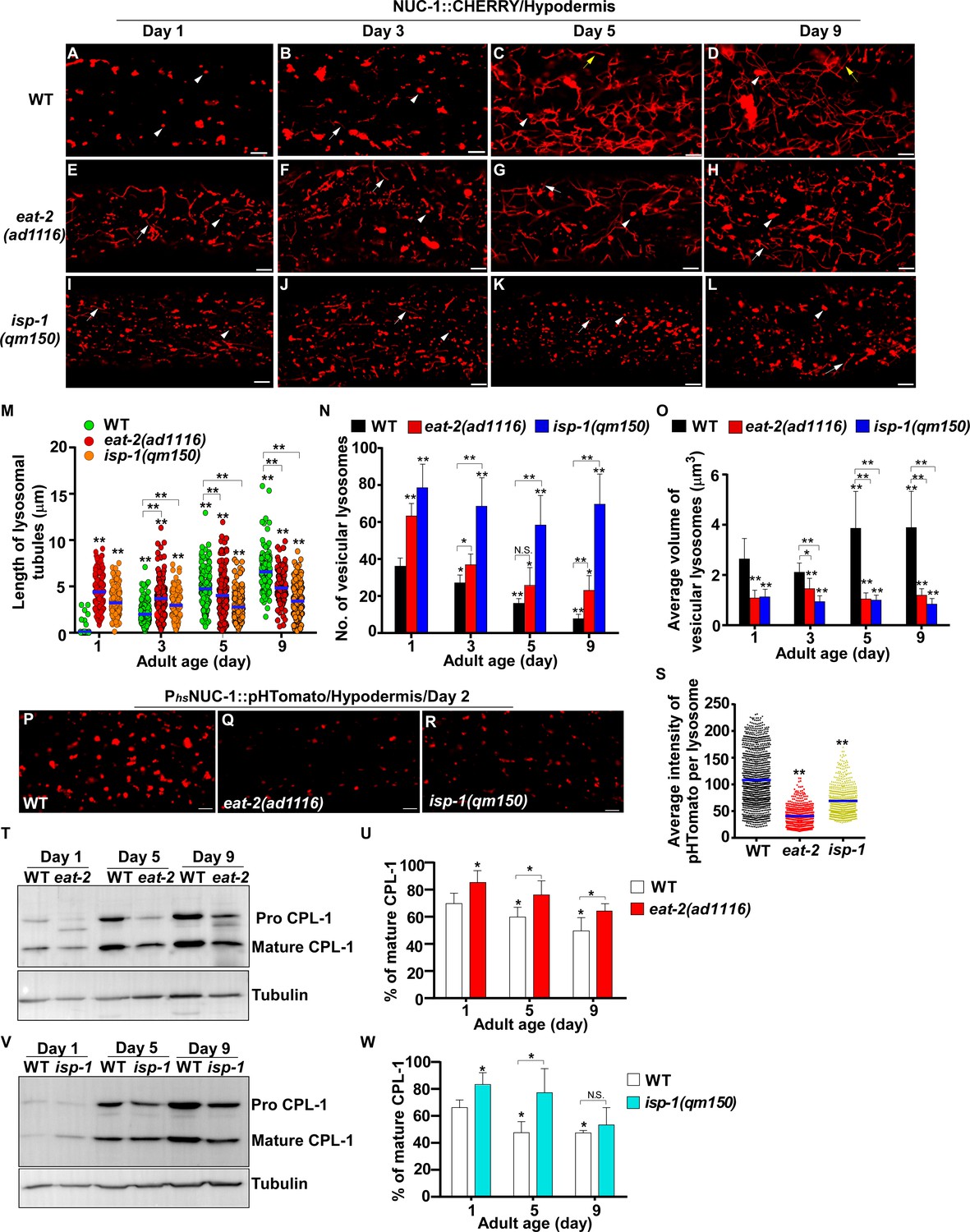 Lysosome activity is modulated by multiple longevity pathways and is ...