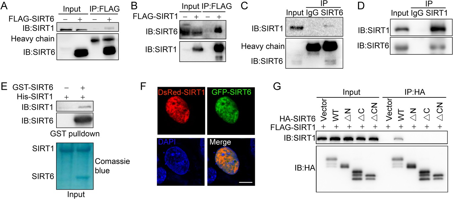 Synergy Between Sirt And Sirt Helps Recognize Dna Breaks And