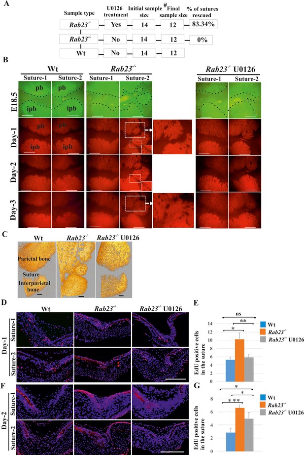 Rab Coordinates Early Osteogenesis By Repressing Fgf Perk And