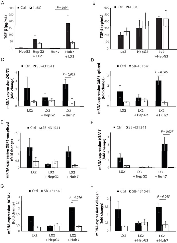 Figures and data in Inhibiting IRE1α-endonuclease activity decreases ...