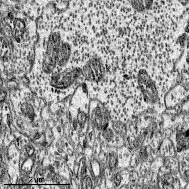 Figures and data in Connectomic analysis reveals an interneuron with an ...