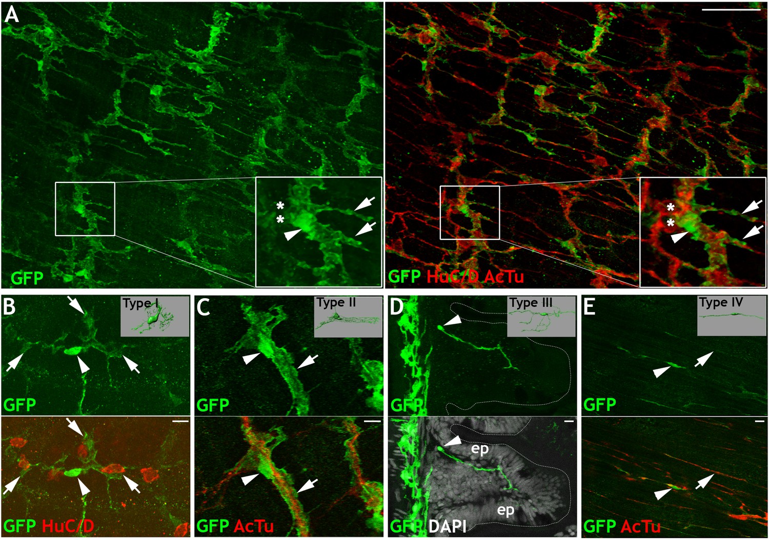 Figures and data in Enteric glia as a source of neural progenitors in ...