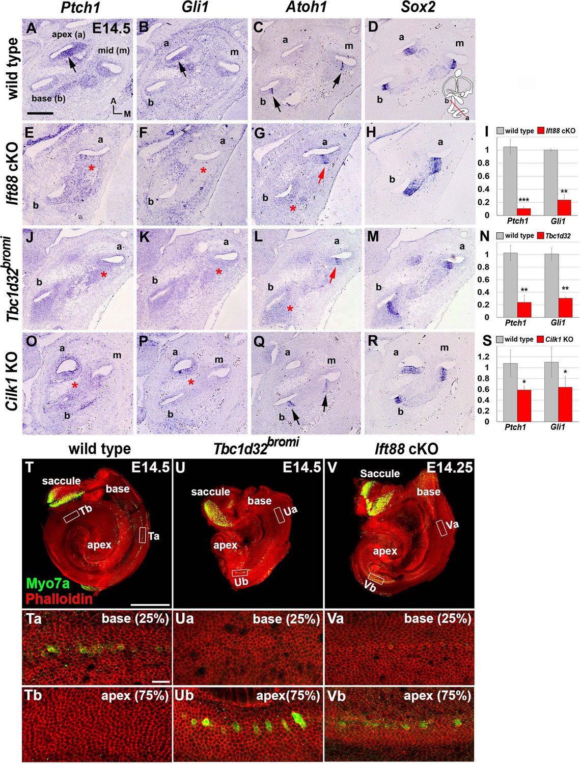 Dysregulation of sonic hedgehog signaling causes hearing loss in ciliopathy mouse models eLife image