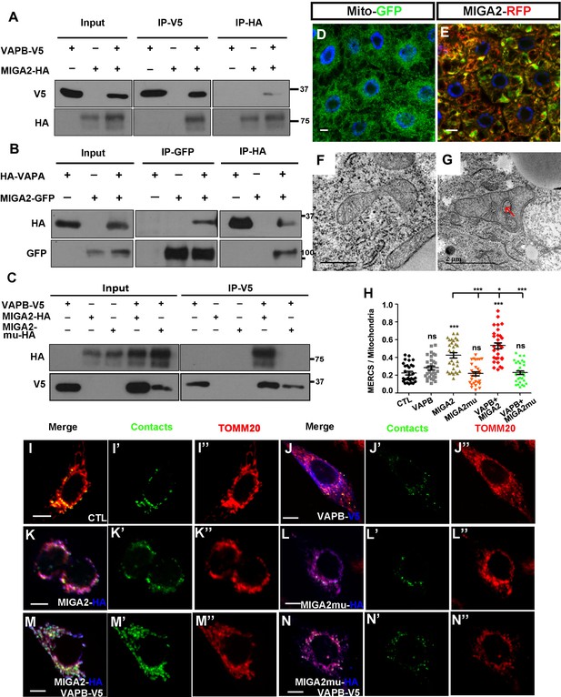 Miga-mediated Endoplasmic Reticulum–mitochondria Contact Sites Regulate ...