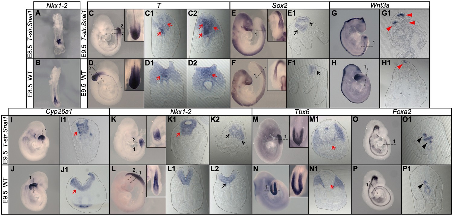 A Tgfbr1/Snai1-dependent developmental module at the core of