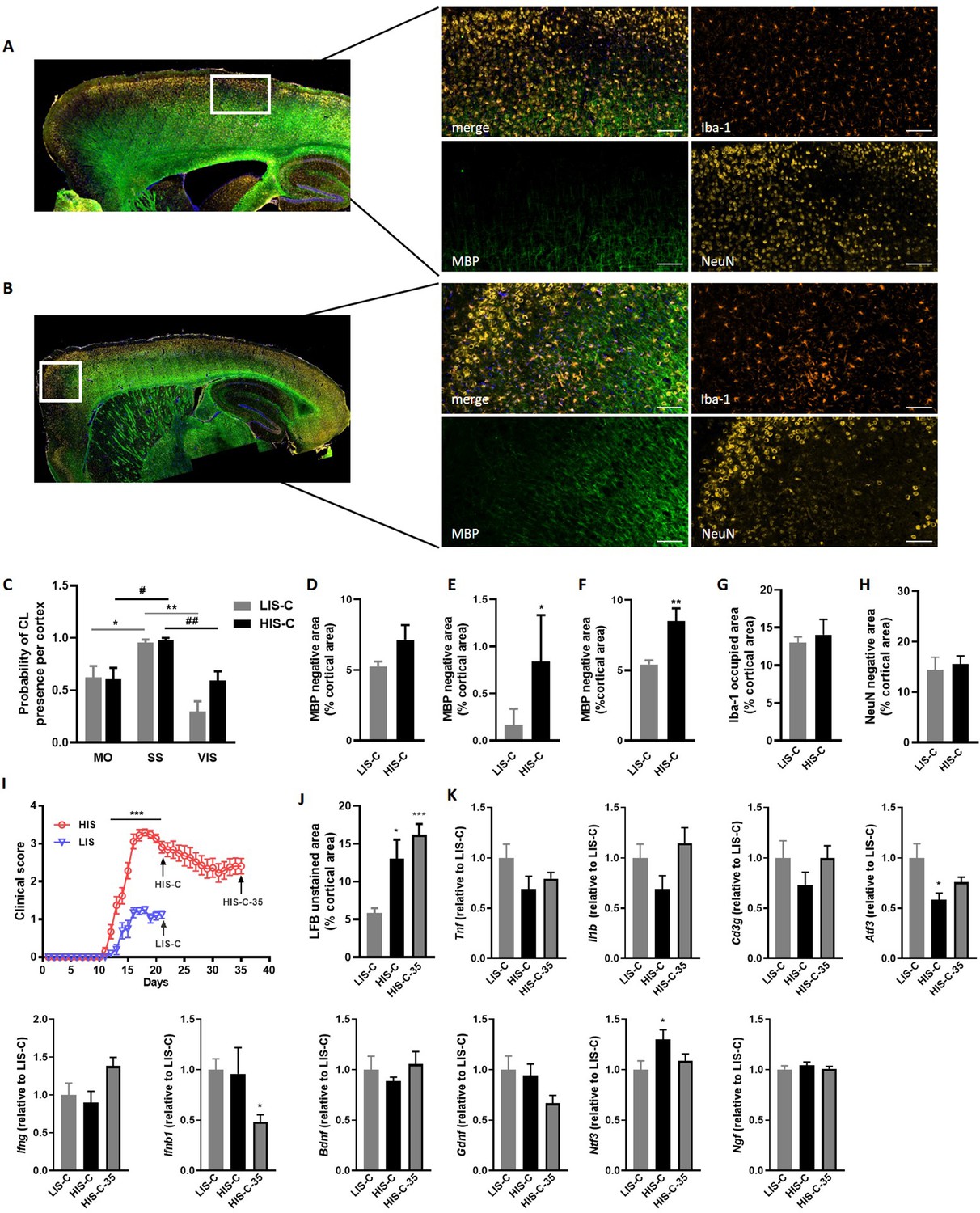 miRNA profile is altered in a modified EAE mouse model of multiple 