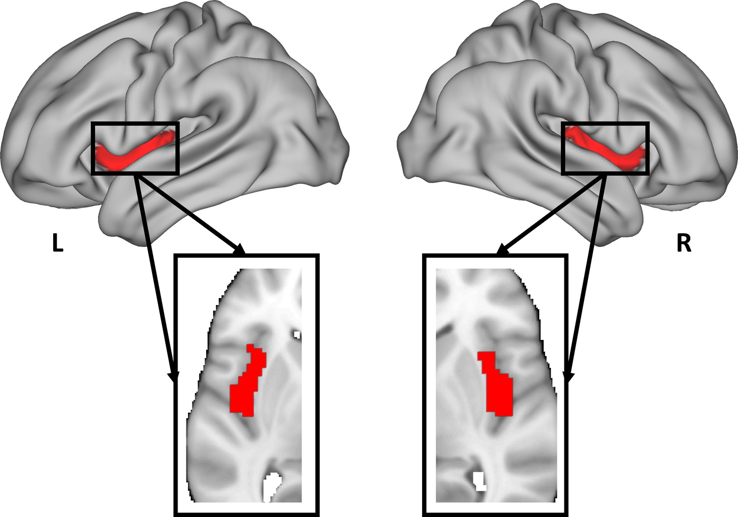 Figures And Data In Empathic Pain Evoked By Sensory And Emotional 