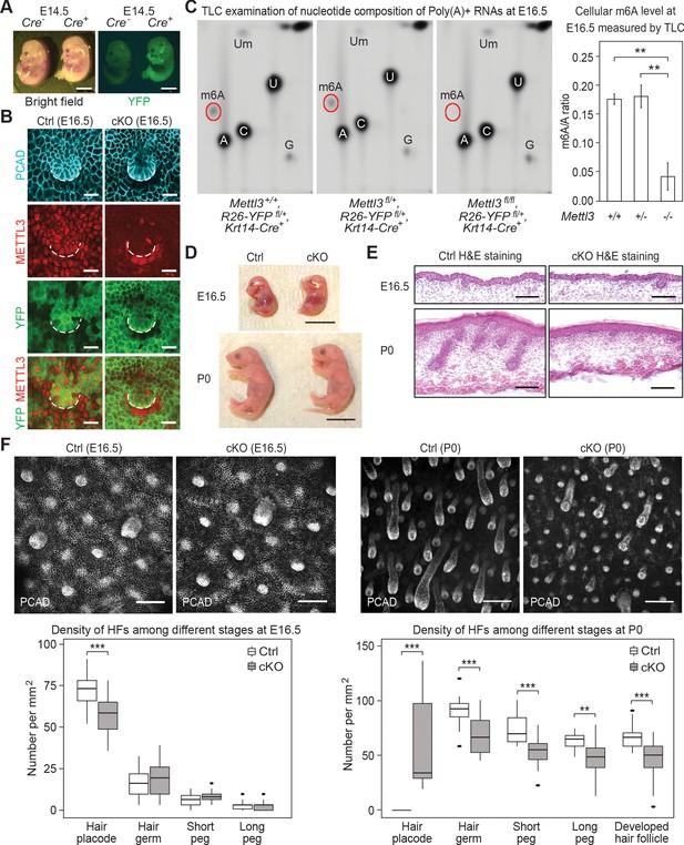 m6A RNA methylation impacts fate choices during skin morphogenesis | eLife