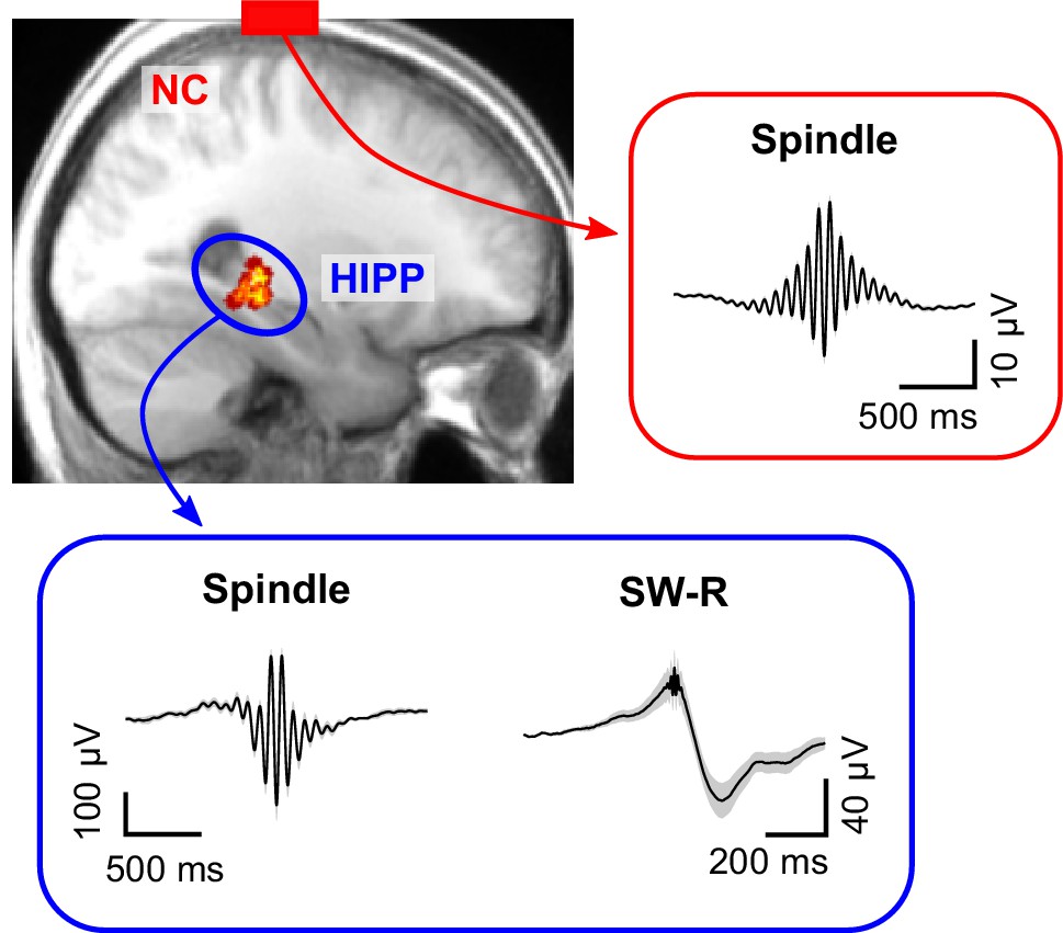 Figures and data in sleep spindles mediate hippocampal neocortical