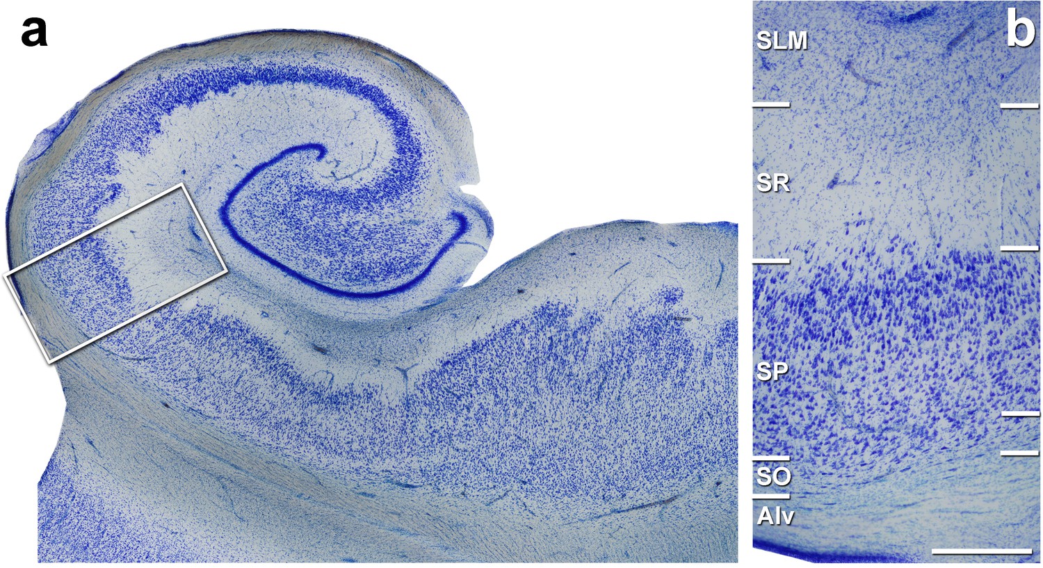 Figures And Data In Three Dimensional Synaptic Organization Of The