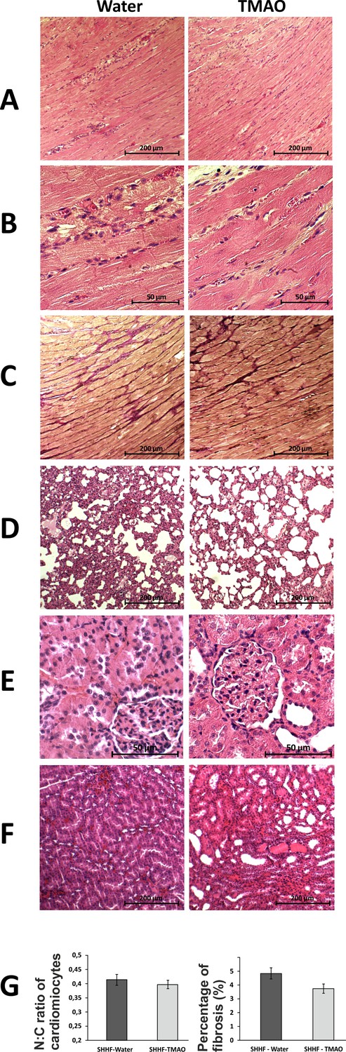 Figures and data in TMAO, a seafood-derived molecule, produces diuresis ...