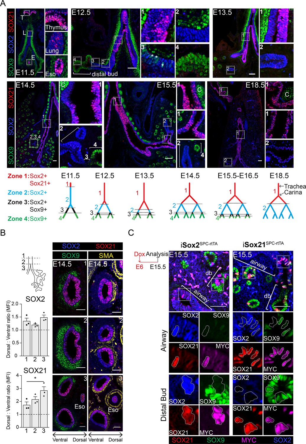 SOX21 Modulates SOX2 Initiated Differentiation Of Epithelial Cells In