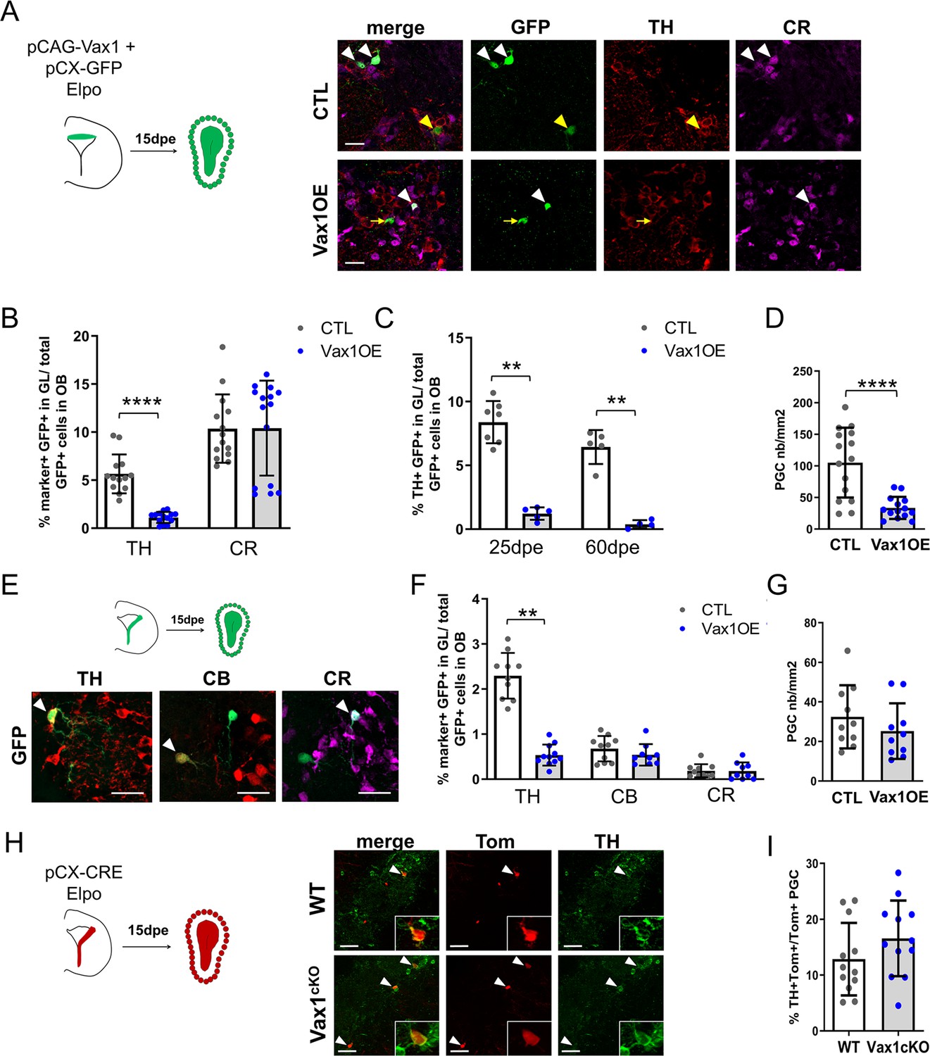 Stem cell regionalization bulb neurogenesis depends regulatory interactions between Vax1 and | eLife