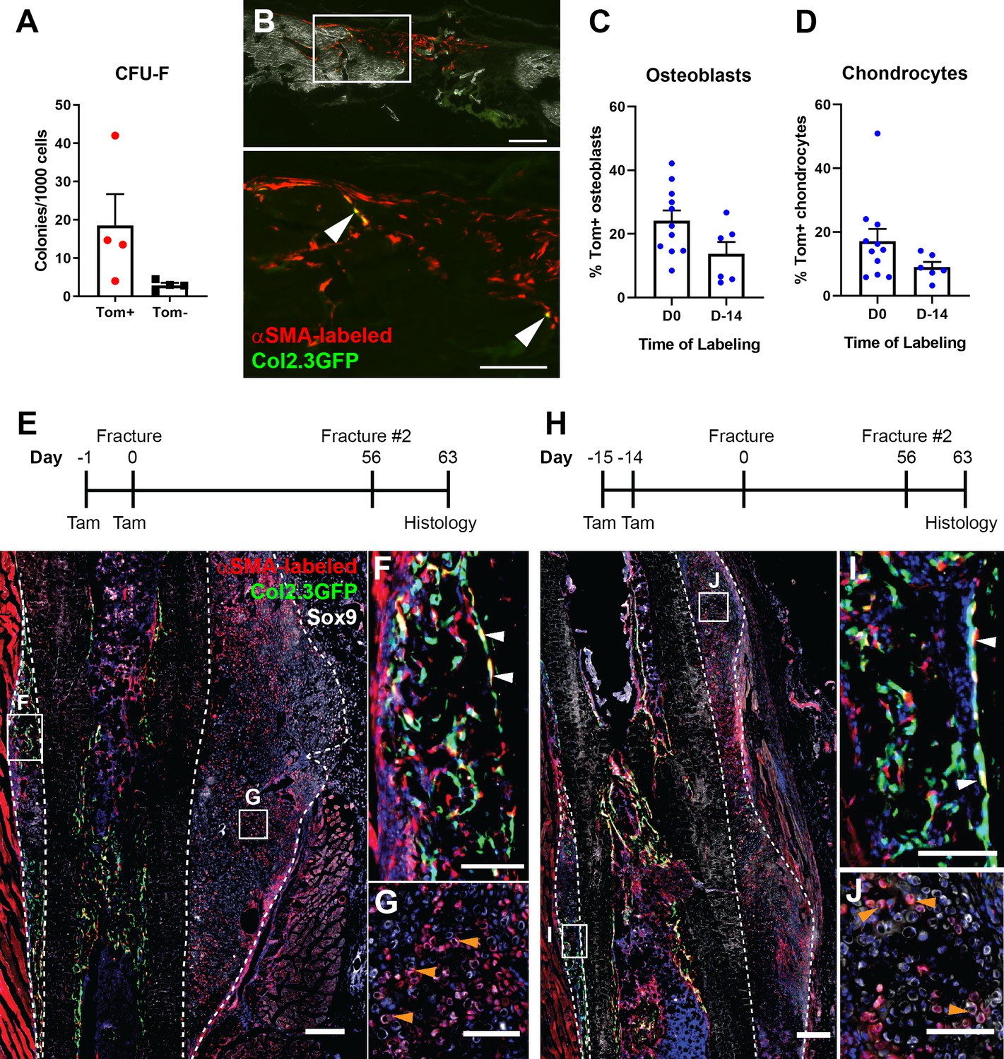 Figures and data in Heterogeneity of murine periosteum progenitors ...