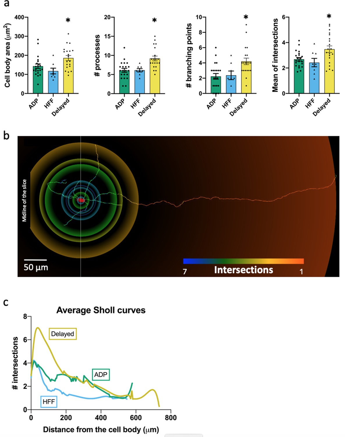 Heterogeneous somatostatin-expressing neuron population in mouse ventral  tegmental area | eLife