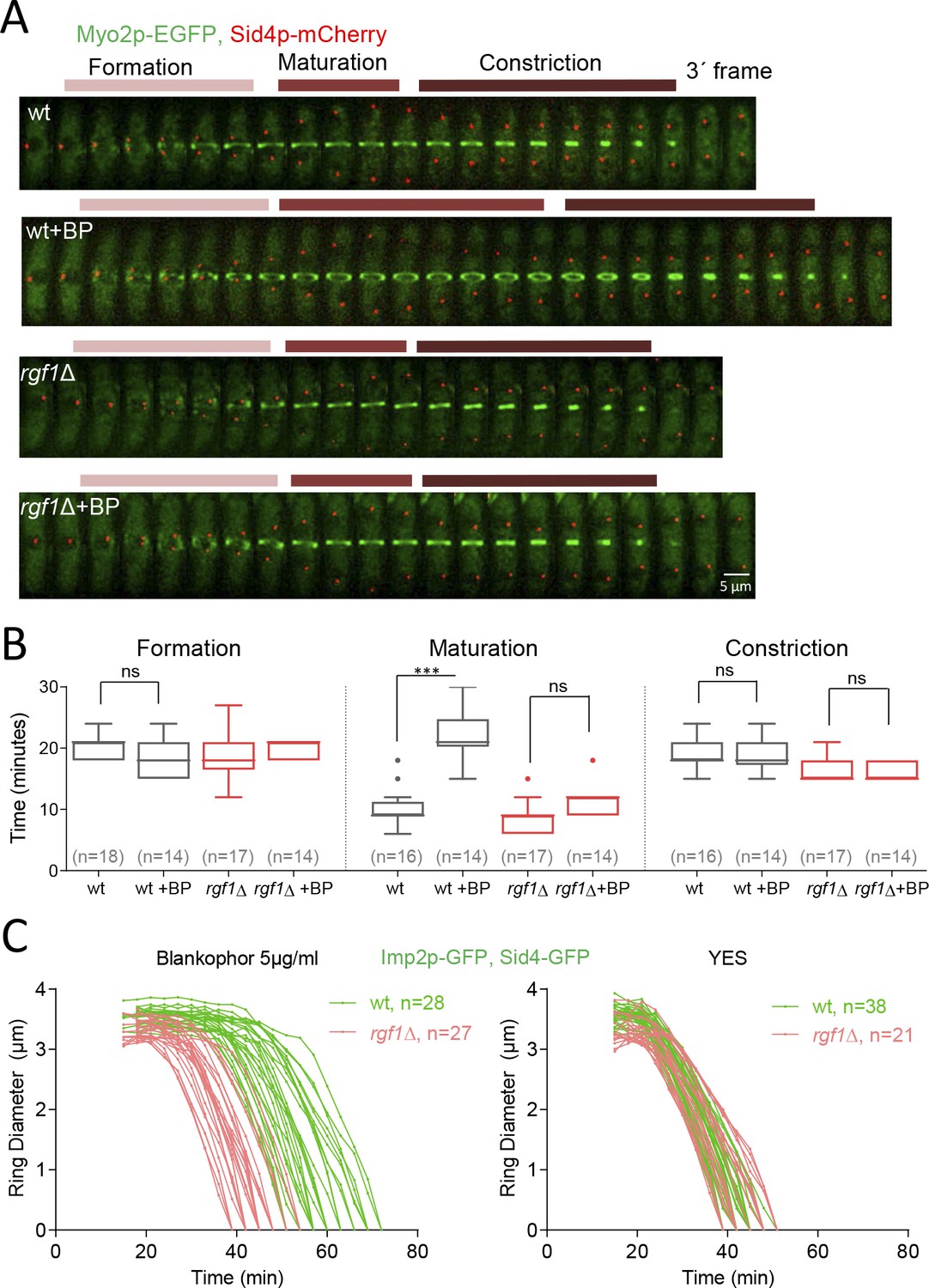 A novel checkpoint pathway controls actomyosin ring constriction trigger in fission yeast eLife