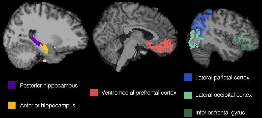 Tracking prototype and exemplar representations in the brain