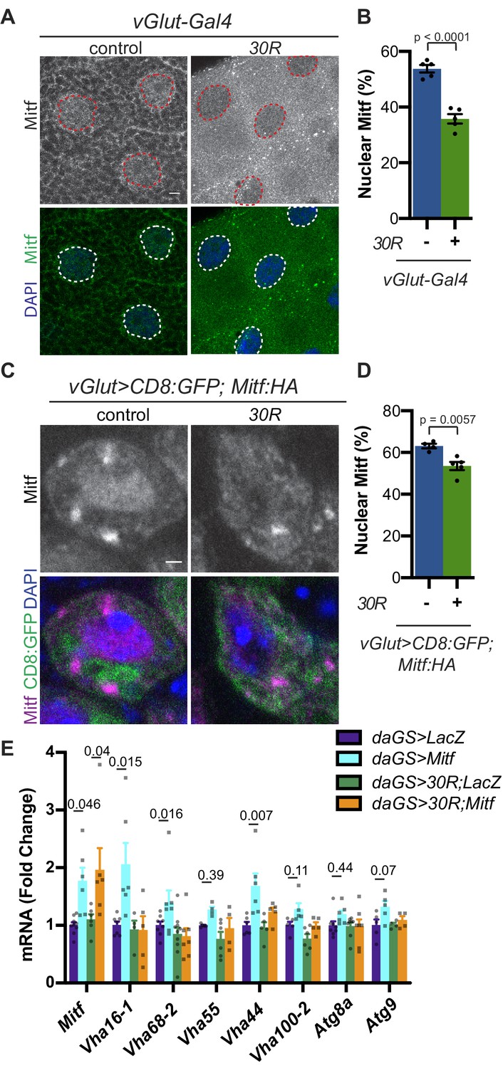TFEB/Mitf links impaired nuclear import to autophagolysosomal 