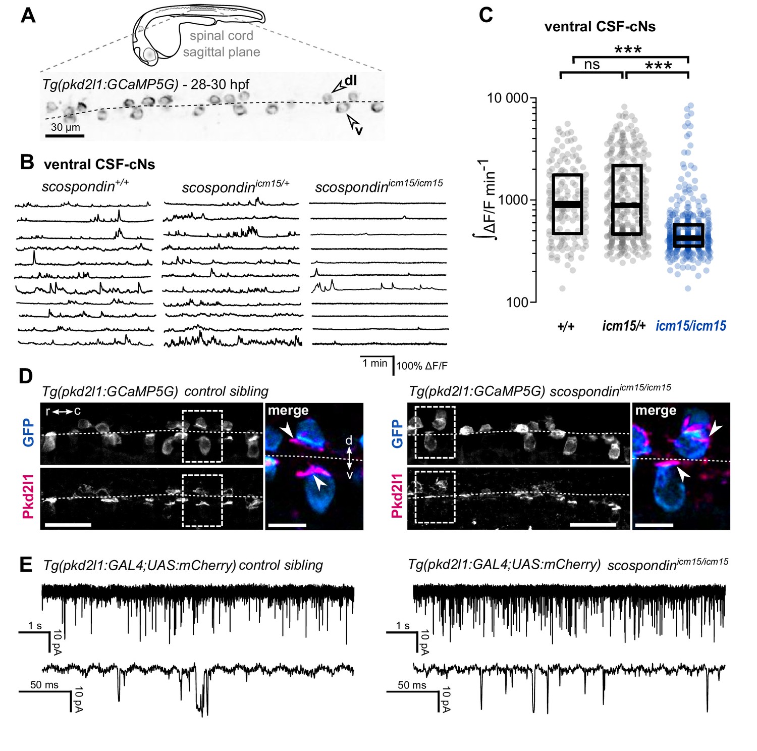 Adrenergic activation modulates the signal from the Reissner fiber ...