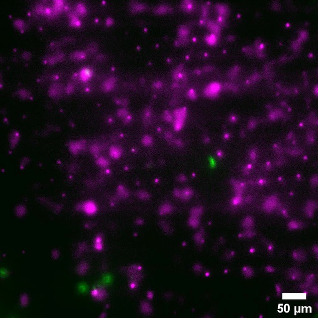 Figures and data in A lung-on-chip model of early Mycobacterium ...