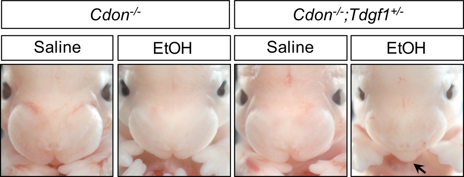 Both C57BL/KsJ (H2d haplotype) and CB10-H2 (H2b haplotype) mice are highly  susceptible to congenital toxoplasmosis - ScienceDirect