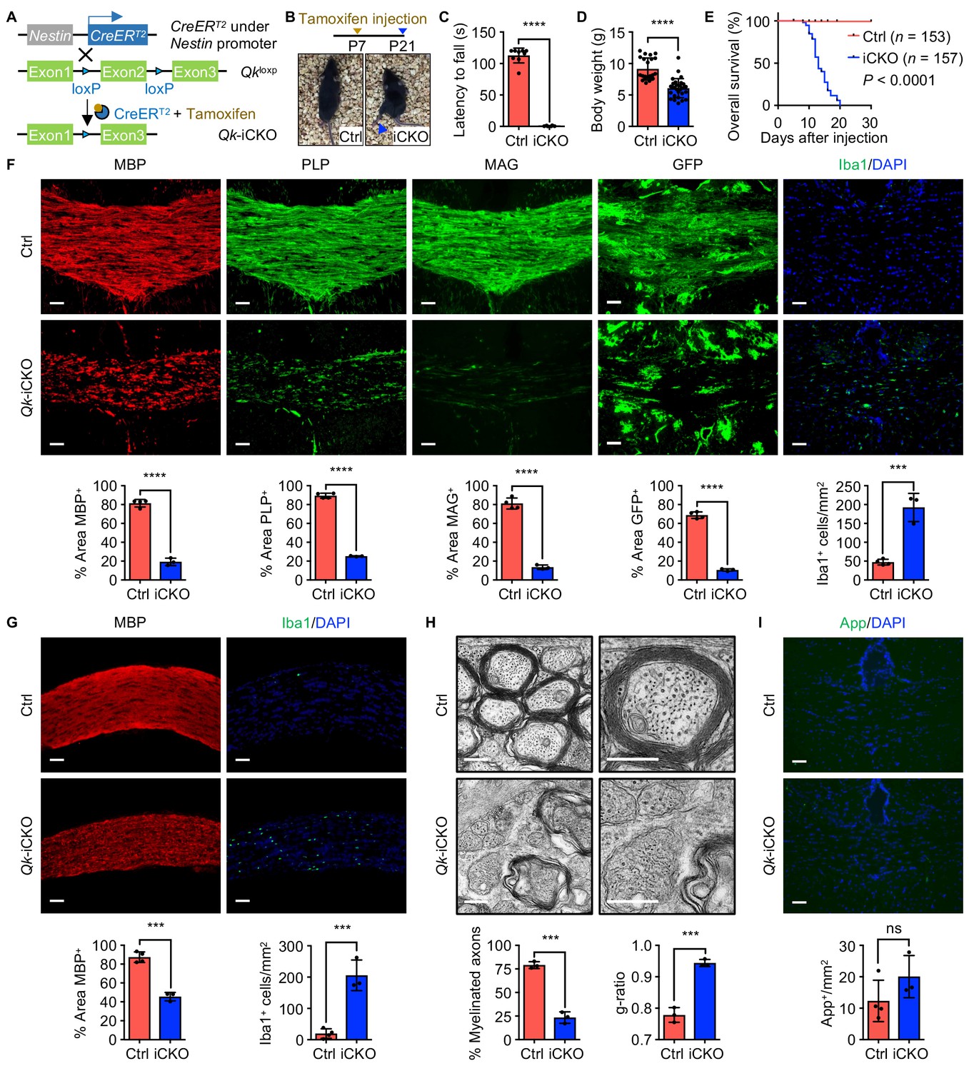 Qki regulates myelinogenesis through Srebp2-dependent cholesterol 