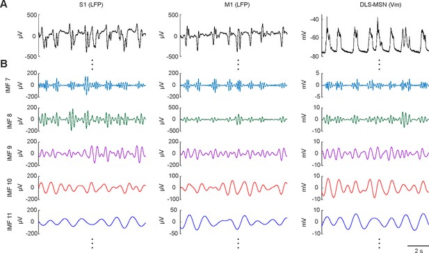 Figures and data in Medium spiny neurons activity reveals the discrete ...