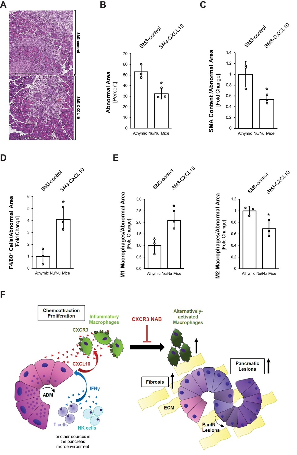 CXCL10/CXCR3 signaling contributes to an inflammatory microenvironment and  its blockade enhances progression of murine pancreatic precancerous lesions