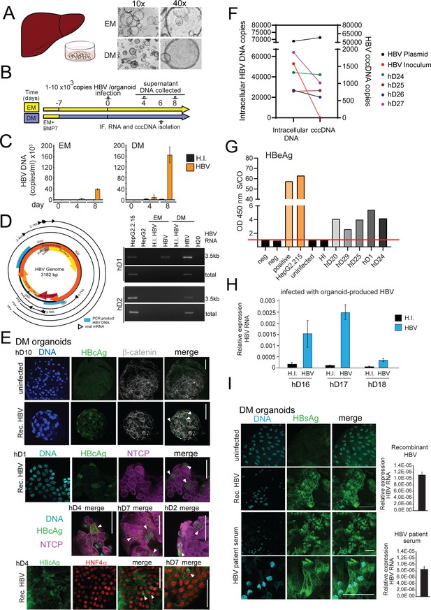 Application of human liver organoids as a patient-derived primary model ...