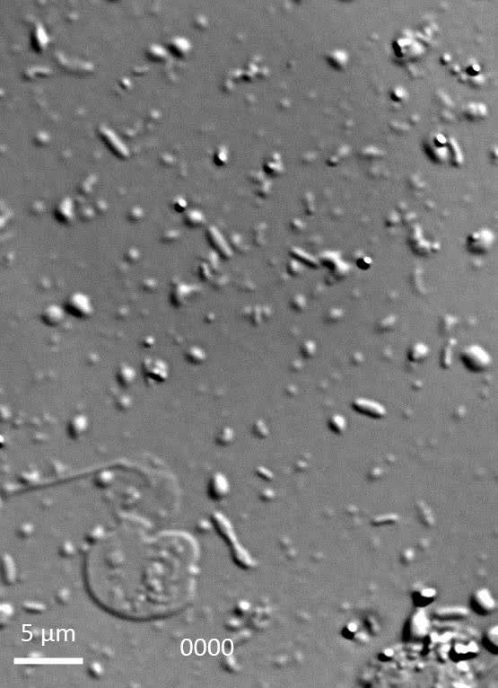 A flagellate-to-amoeboid switch in the closest living relatives of animals  | eLife