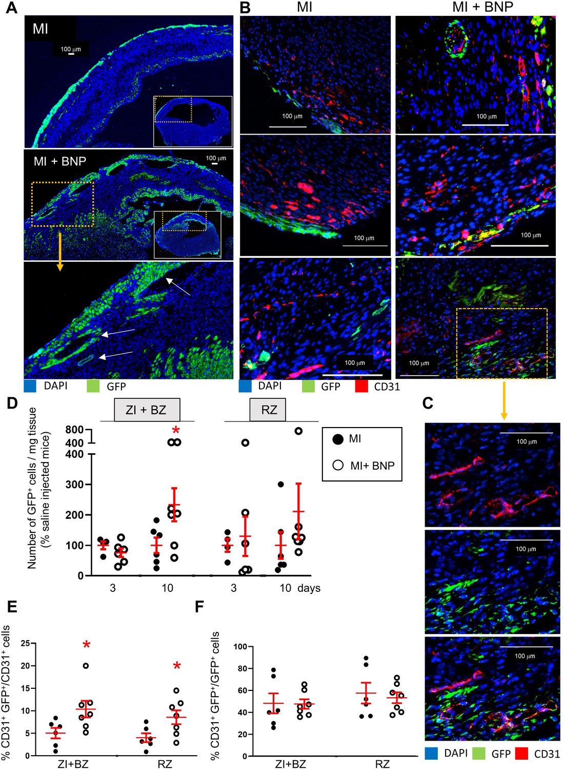 Increasing heart vascularisation after myocardial infarction using ...