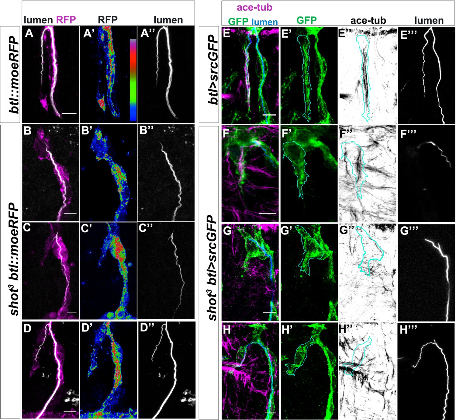 Coordinated Crosstalk Between Microtubules And Actin By A Spectraplakin Regulates Lumen Formation And Branching Elife