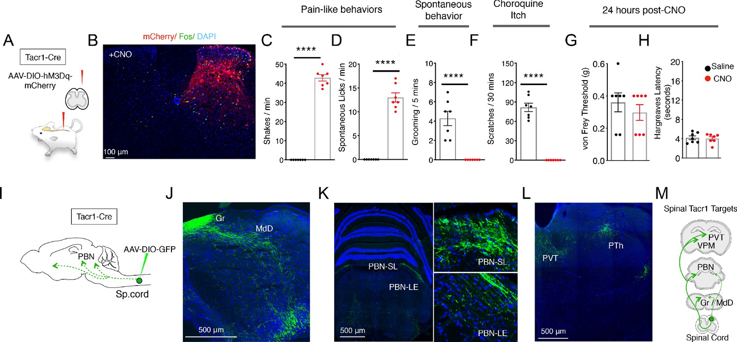 A spinoparabrachial circuit defined by Tacr1 expression drives pain | eLife