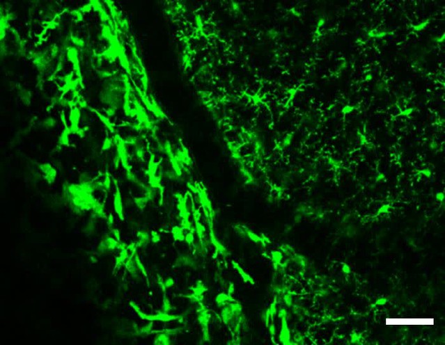 The role of P2Y12 in the kinetics of microglial self-renewal