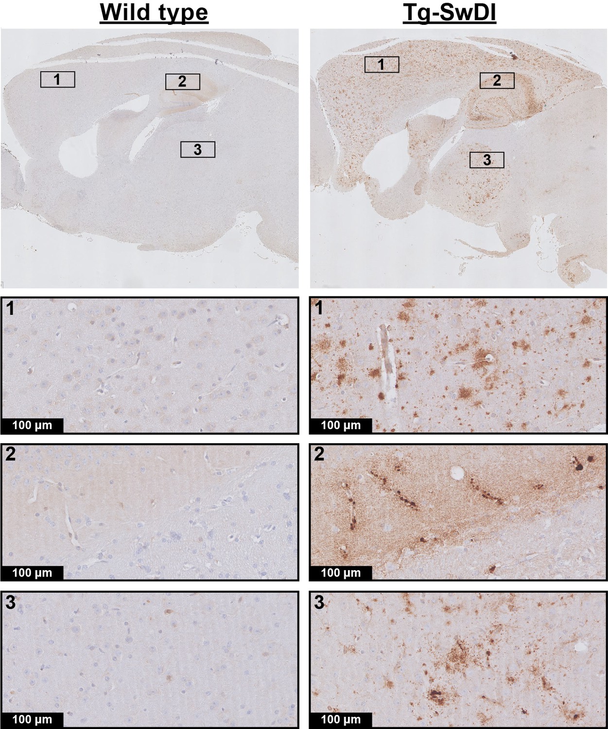 Figures And Data In Cerebral Blood Flow And Cerebrovascular Reactivity ...