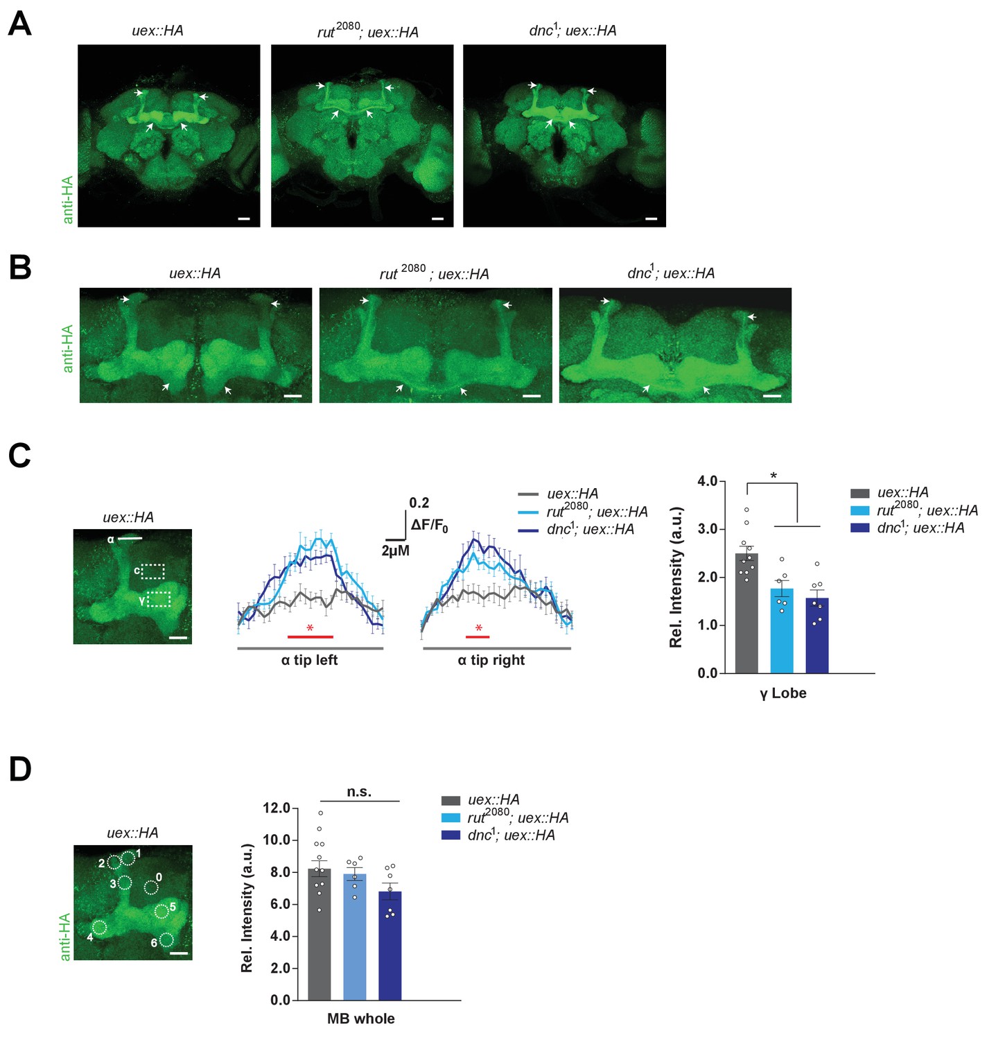 Magnesium Efflux From Drosophila Kenyon Cells Is Critical For Normal And Diet Enhanced Long Term Memory Elife