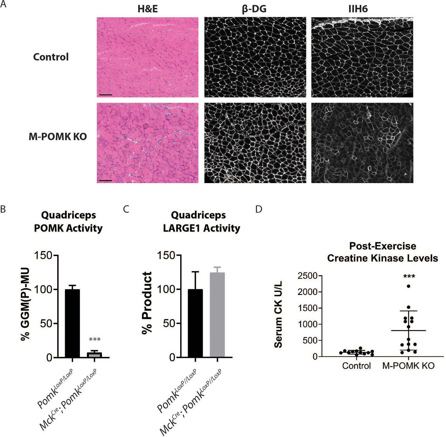 Pomk Regulates Dystroglycan Function Via Large1 Mediated Elongation Of Matriglycan Elife