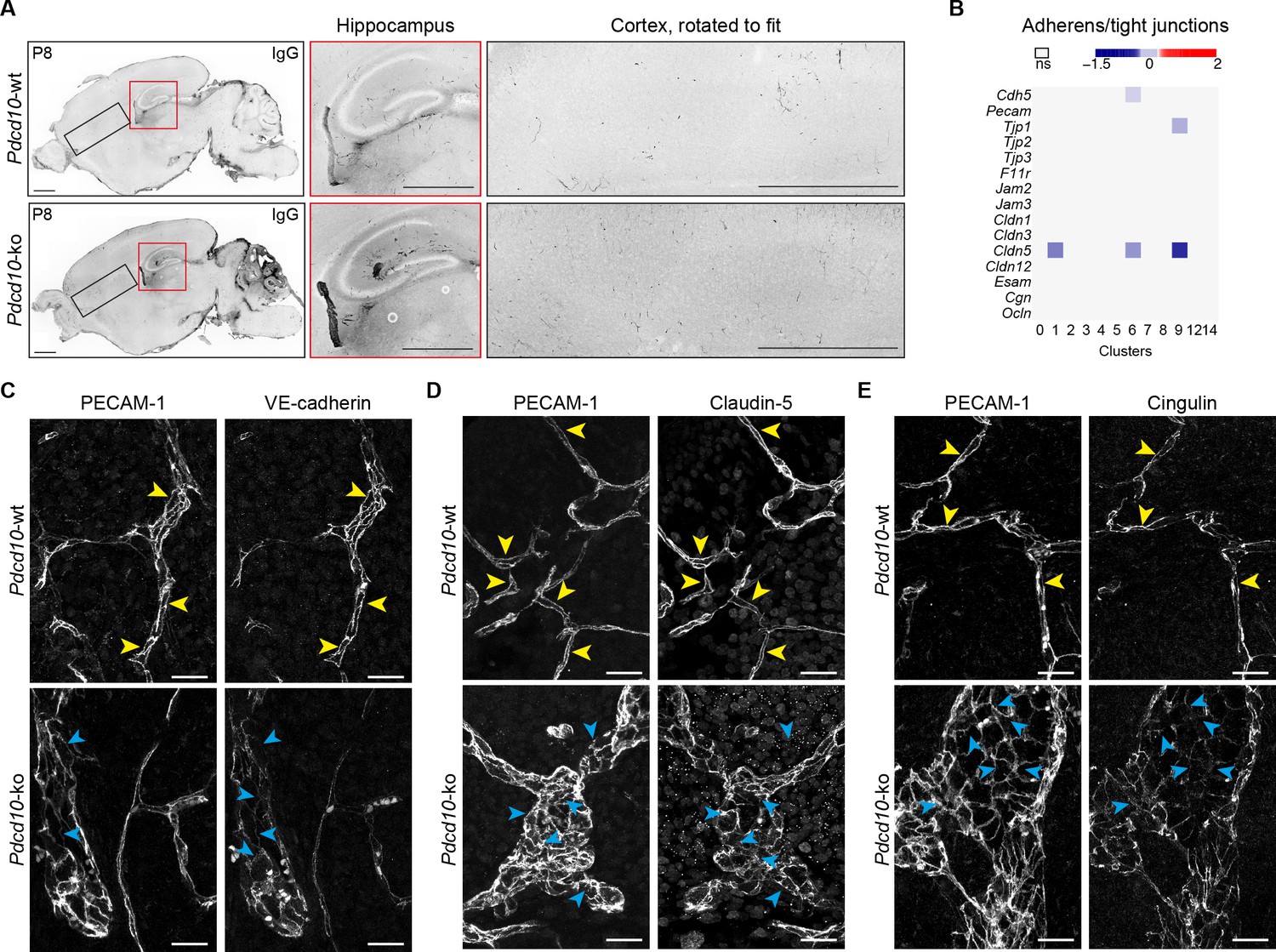 Figures and data in Mapping endothelial-cell diversity in cerebral ...