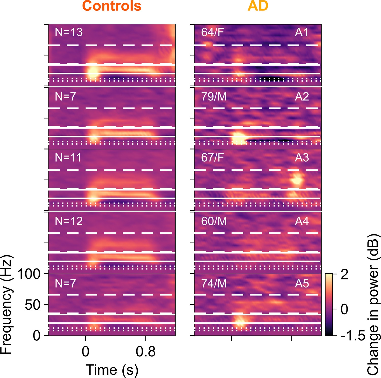 メソシューティカル インサイド -カロヤカコーヒー Stimulus-induced gamma rhythms are weaker in human elderly
