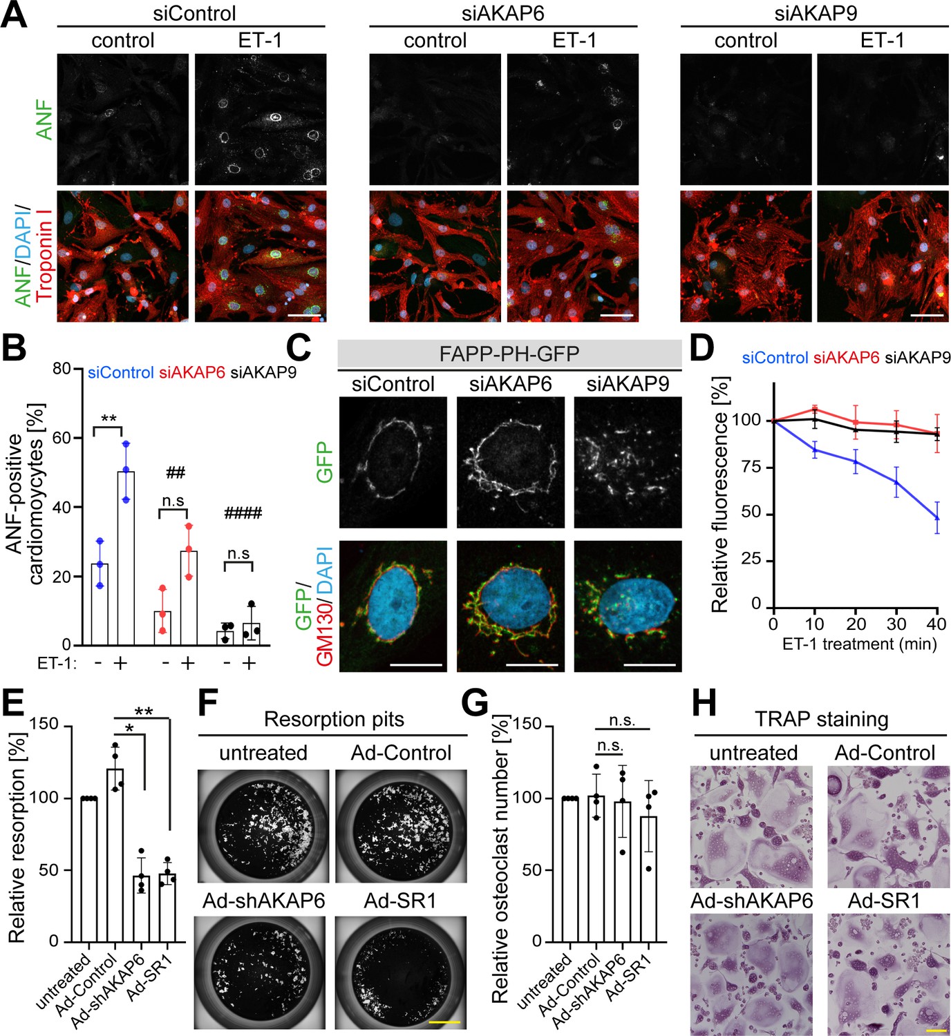 Figures and data in AKAP6 orchestrates the nuclear envelope microtubule ...