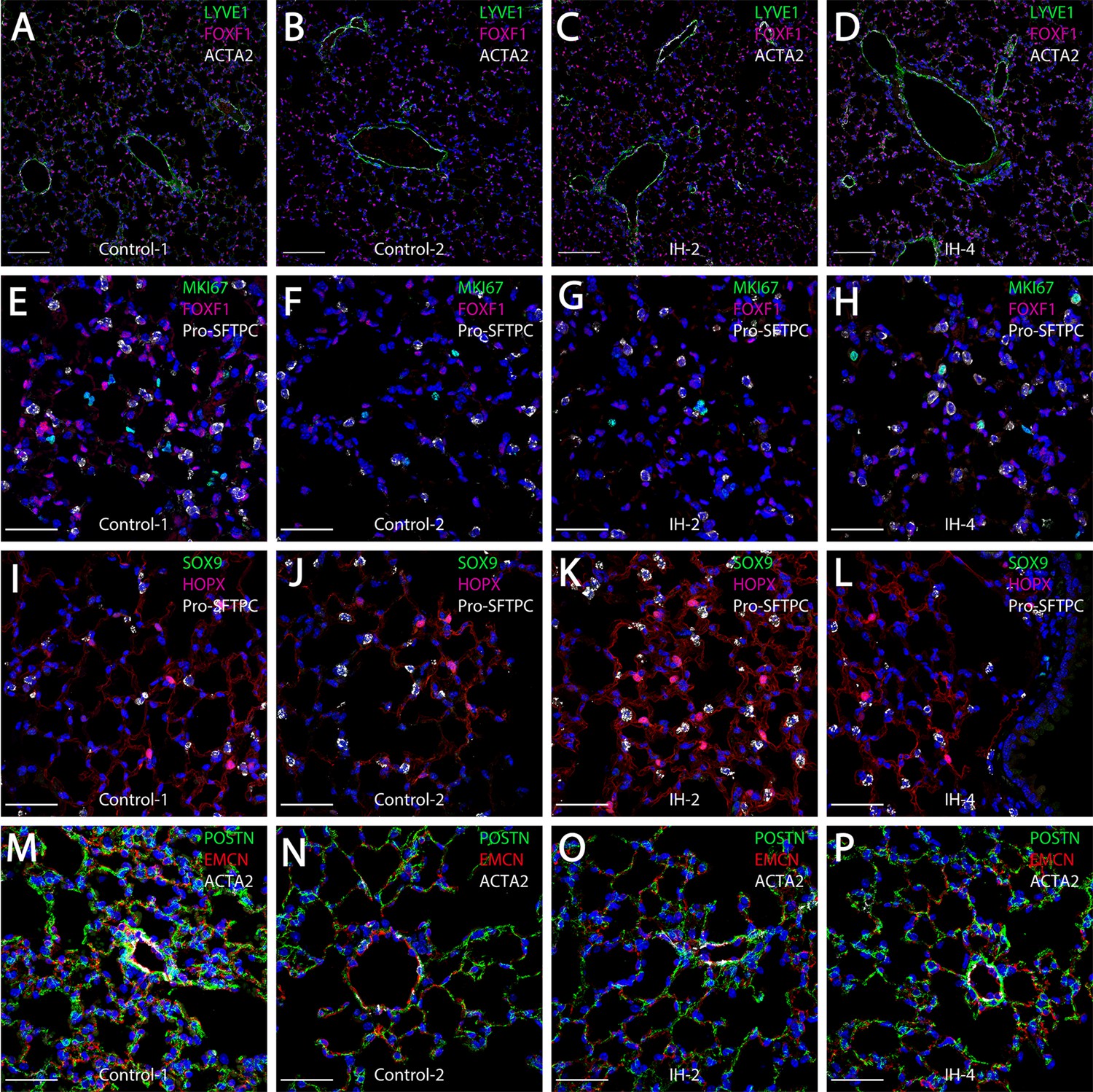 Short-term exposure to intermittent hypoxia leads to changes in gene ...