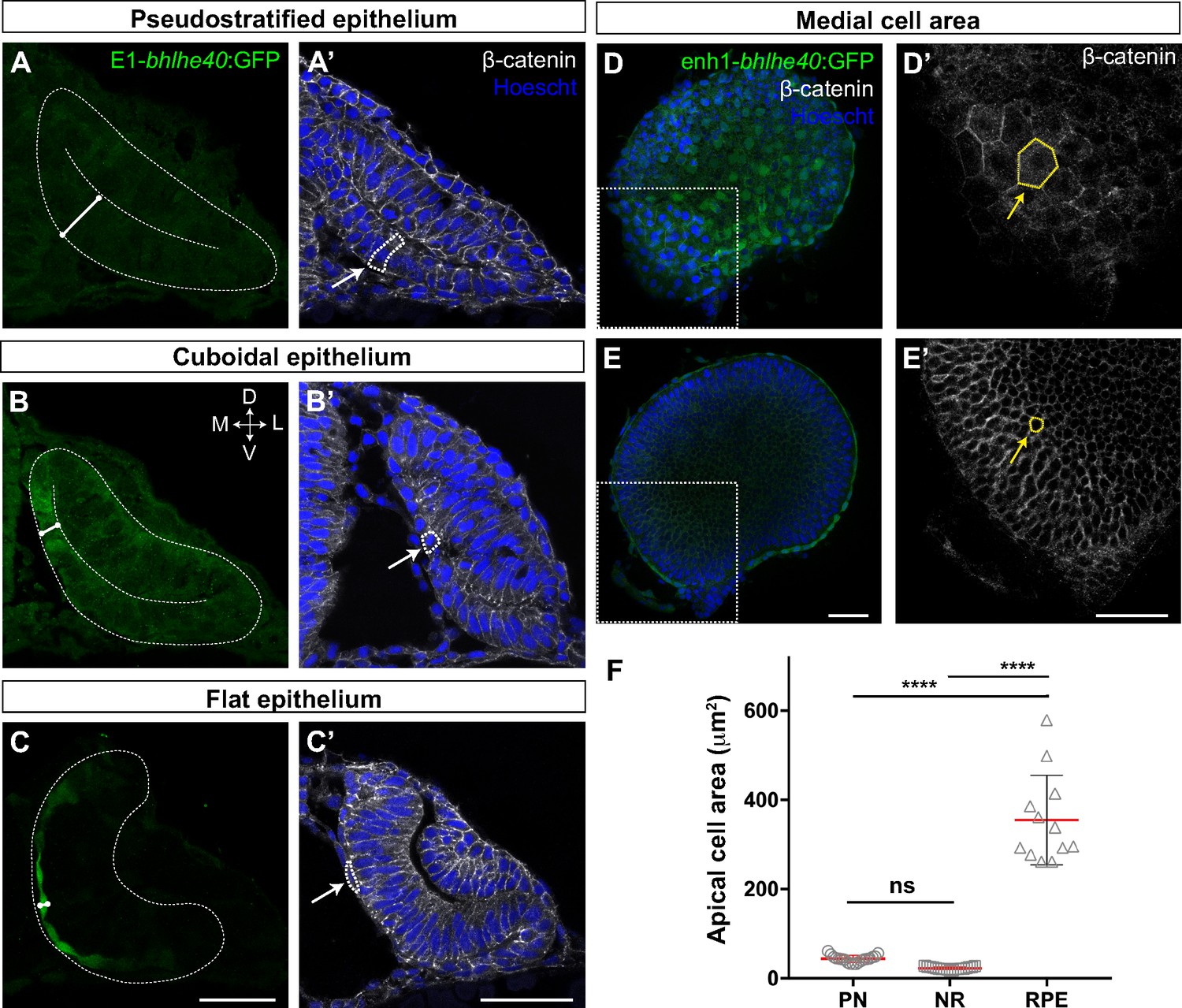 The retina and retinal pigment epithelium (RPE)