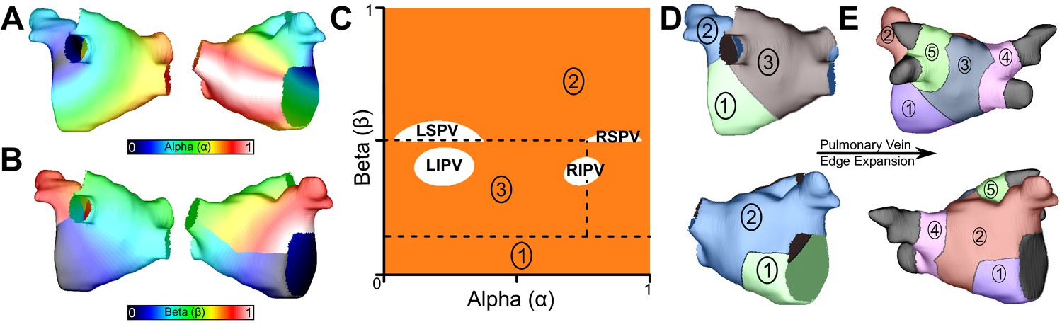 Figures and data in Computational modeling identifies embolic stroke of ...