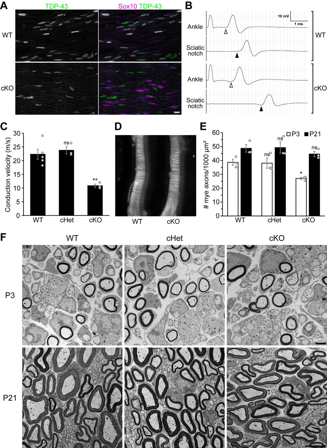 TDP-43 maximizes nerve conduction velocity by repressing a cryptic